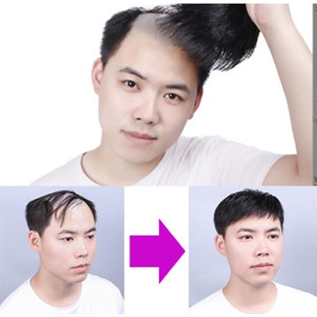 홈조아 이미지