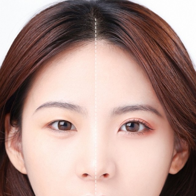 숑숑뷰티 이미지