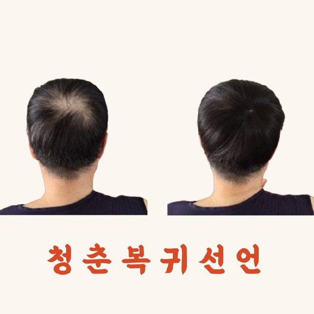 365부분 이미지